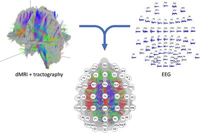 Brain Structural and Functional Connectivity: A Review of Combined Works of Diffusion Magnetic Resonance Imaging and Electro-Encephalography